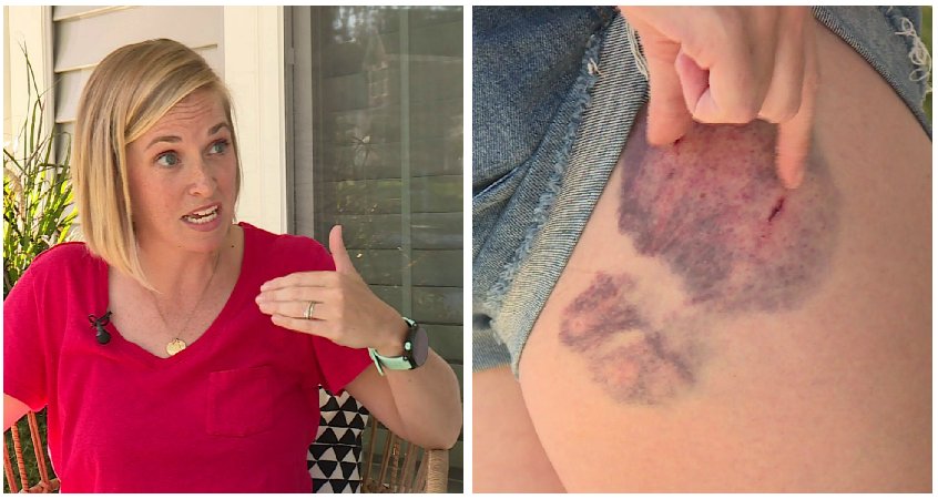 Chesterfield mother attacked by dog while training for marathon    